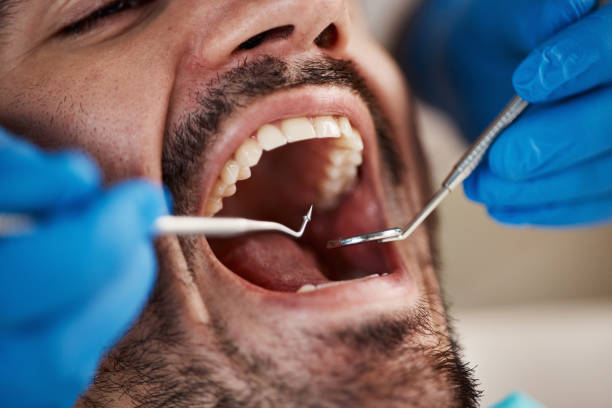 Best Emergency Treatment for Jaw Pain or Injury in Rancho Palos Verdes, CA